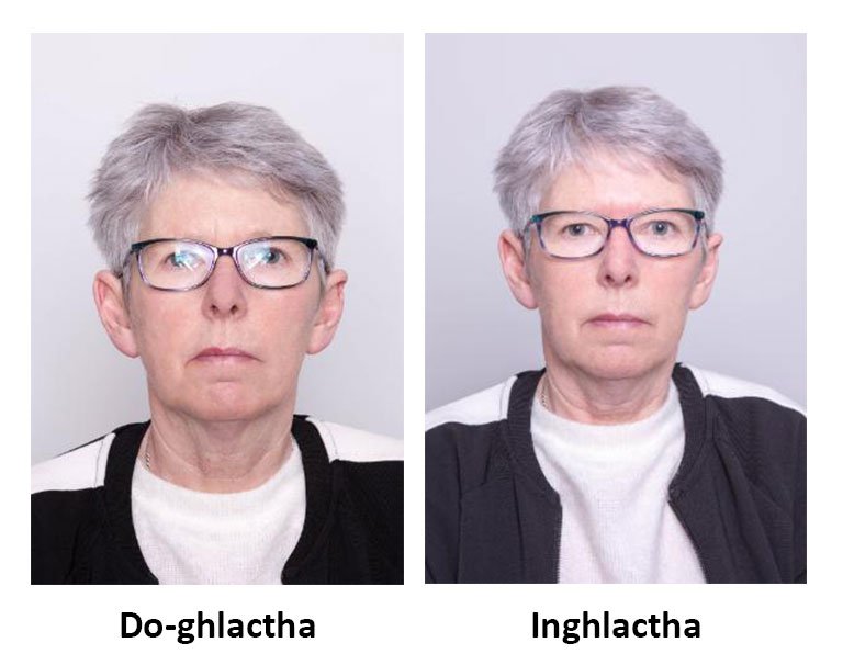 Bean le dallrú ar a spéaclaí leis an bhfotheidil 'Do-ghlactha', le leagan inghlactha taobh leis gan aon dallrú.