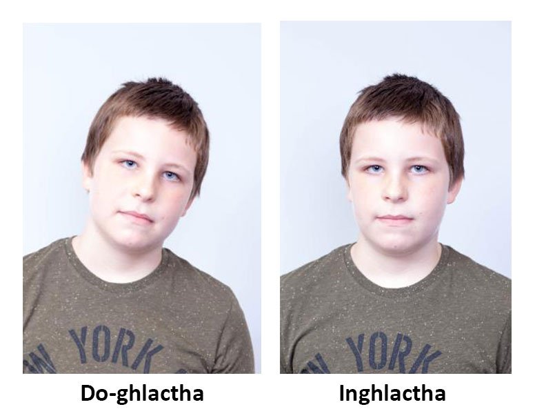 Dhá sheat cinn de bhuachaill óg, sa cheann atá marcáilte do-ghlactha, tá an buachaill ar claon. Sa ghrianghraf inghlactha, feictear é ina sheasamh díreach ar aghaidh.